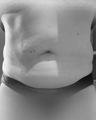Photo après, Transformation ventre et hanches