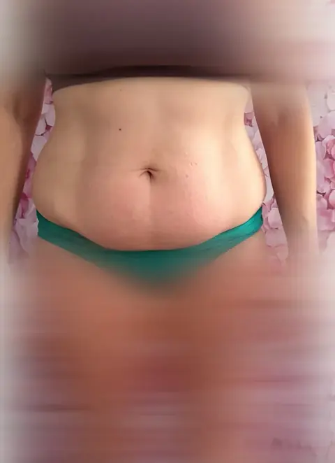 Photo après, Transformation ventre