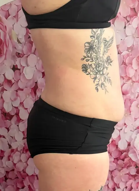 Photo après, Transformation ventre