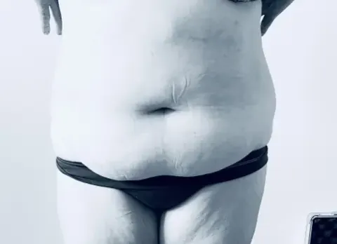 Photo après
