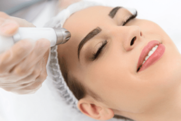 Microneedling